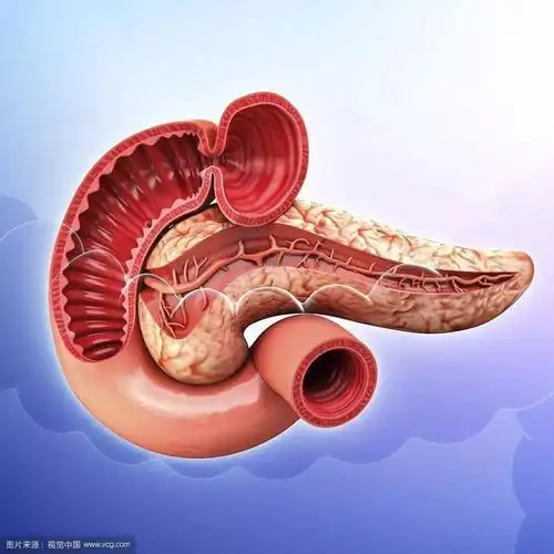 消化专题我国慢性胰腺炎的研究现状关于慢胰研究15年的故事