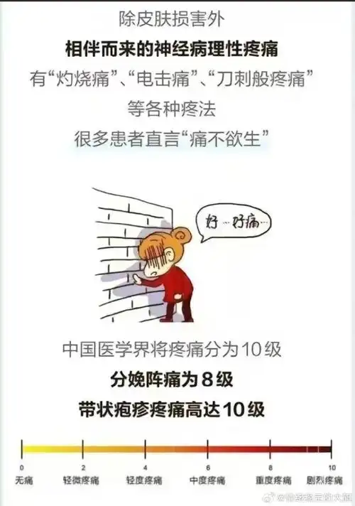 带状疱疹是最疼的皮肤病之一