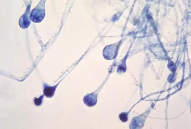 霉菌在发酵罐中转速能不能提高,跟文献这么不相符合?