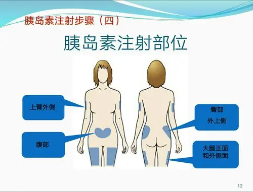 冀州区医院内一科2018年第五期糖尿病大讲堂开课了!