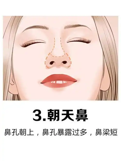 9种常见鼻型,看看你属于哪种?