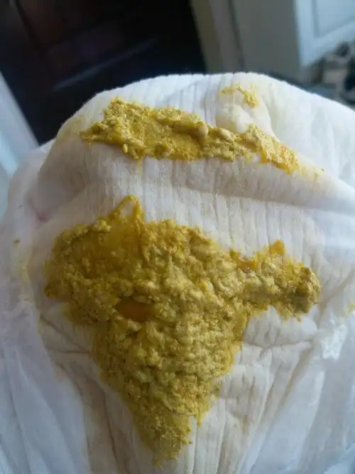 宝宝一天拉四五次这种奶瓣型大便,要怎么办啊?