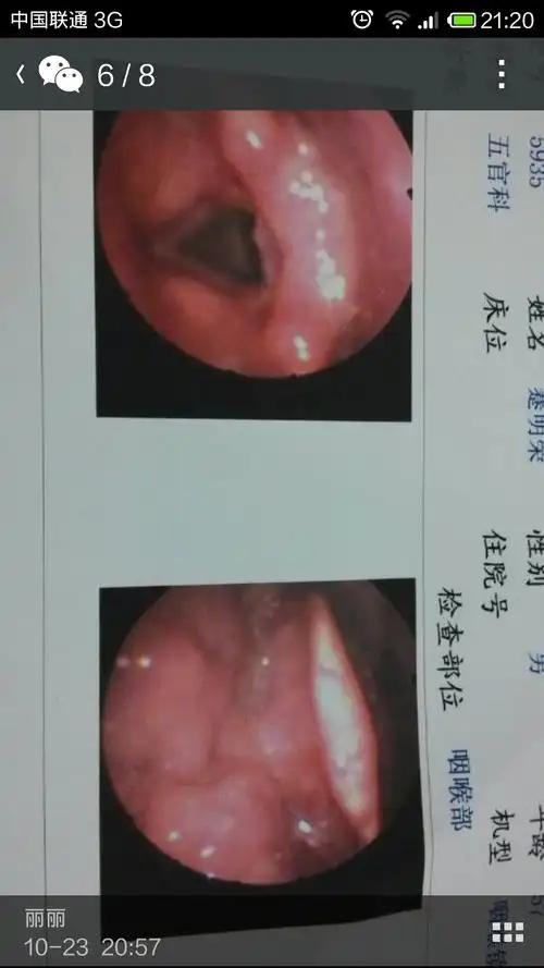 我父亲喉咙痛了两个月了,中途做了两次喉镜都说是咽炎,但_慢性咽炎_邻