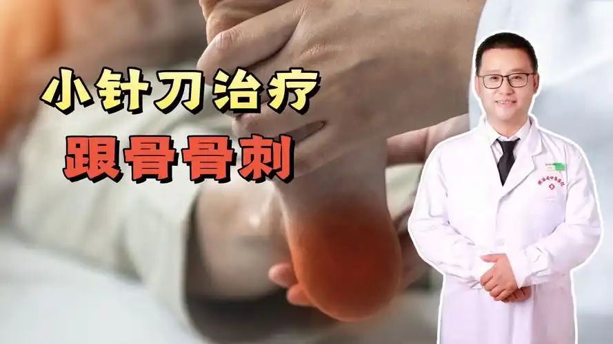 病例分享:小针刀治疗跟骨骨刺