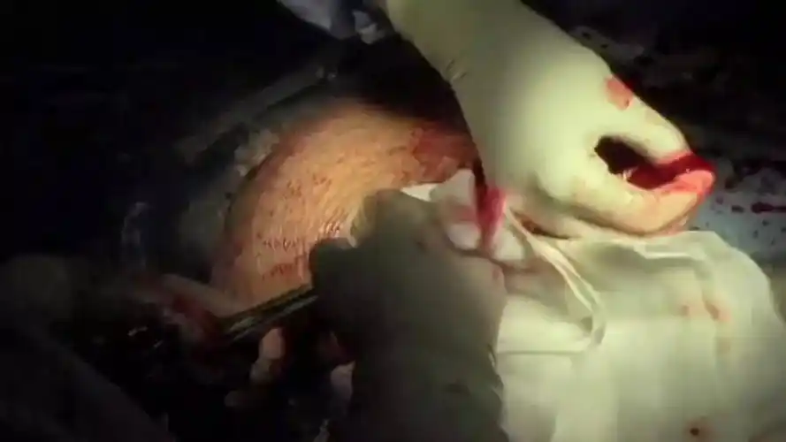 图解生孩子全过程看完就知道妈妈的伟大