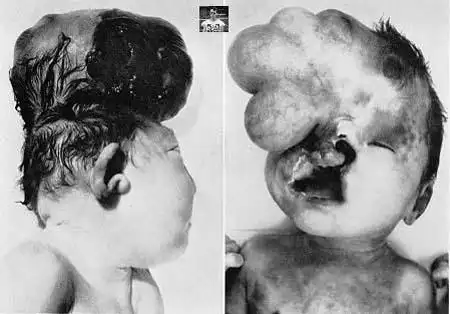 克隆失败的怪婴! (图)