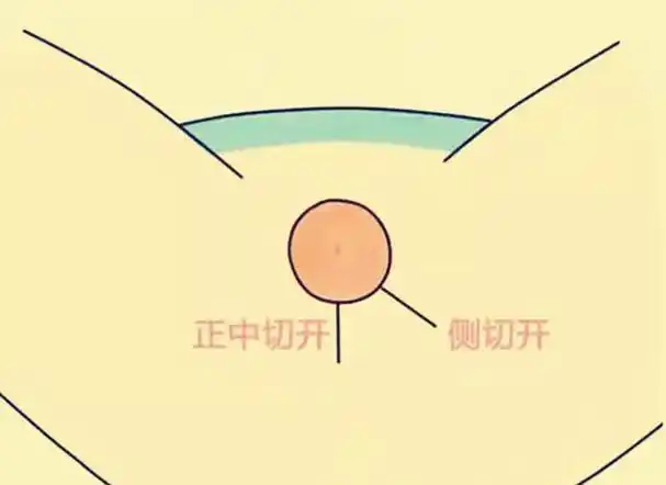 生活天天健康胎儿过重,胎头过大,脑积水等先露部位径线过大,过期胎儿