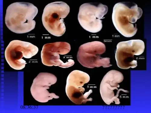 人体胚胎学 ( human embryology ) 人胚早期发生.
