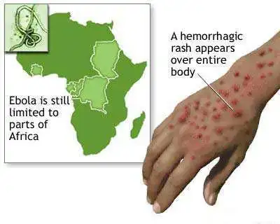 肆虐地球3000年!你知道什么病毒吗?