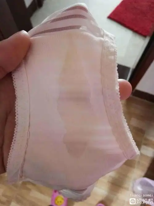 还有就是ph值的情况,最后根据白带常规检查结果明确诊断,看是霉菌性