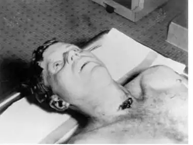 肯尼迪遇刺事件原因 肯尼迪遇刺事件 肯尼迪遇刺真相揭秘