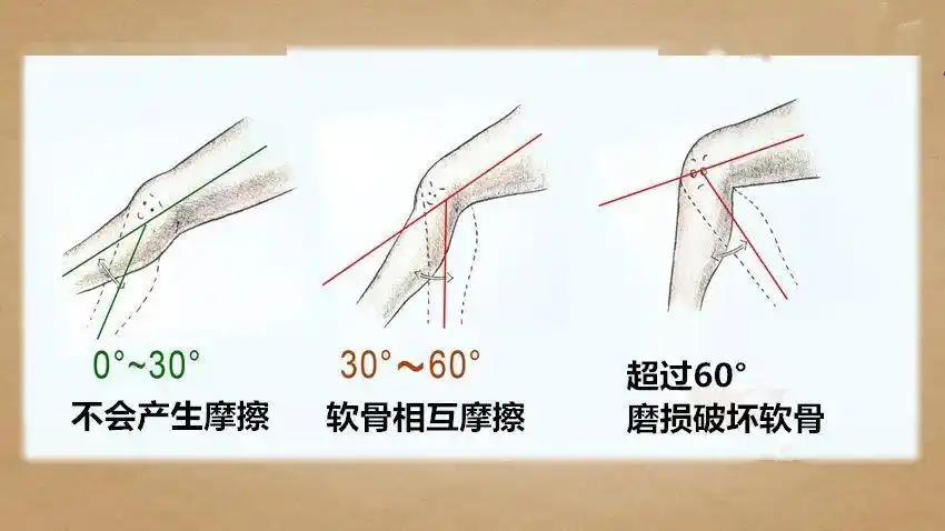 弯太快,才会伤膝盖当膝盖弯曲角度30～60度时,软骨会开始互相摩擦,当