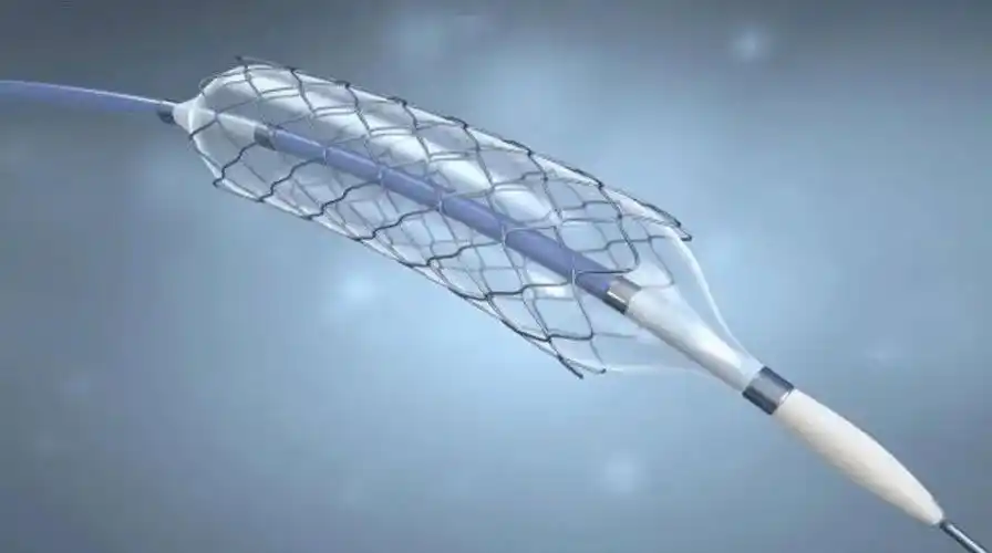 我院心血管内科完成多例心脏支架植入手术