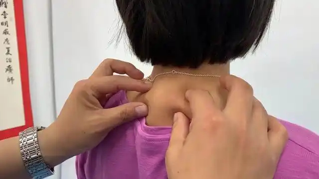 项部脂肪垫俗称"富贵包",常见于肥胖女性,可通过整形手术切除