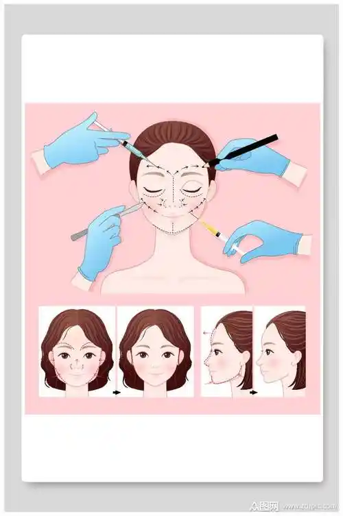 整形美容插画素材海报素材
