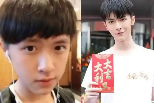 张逸杰整容了吗为什么整容前后对比照太吓人