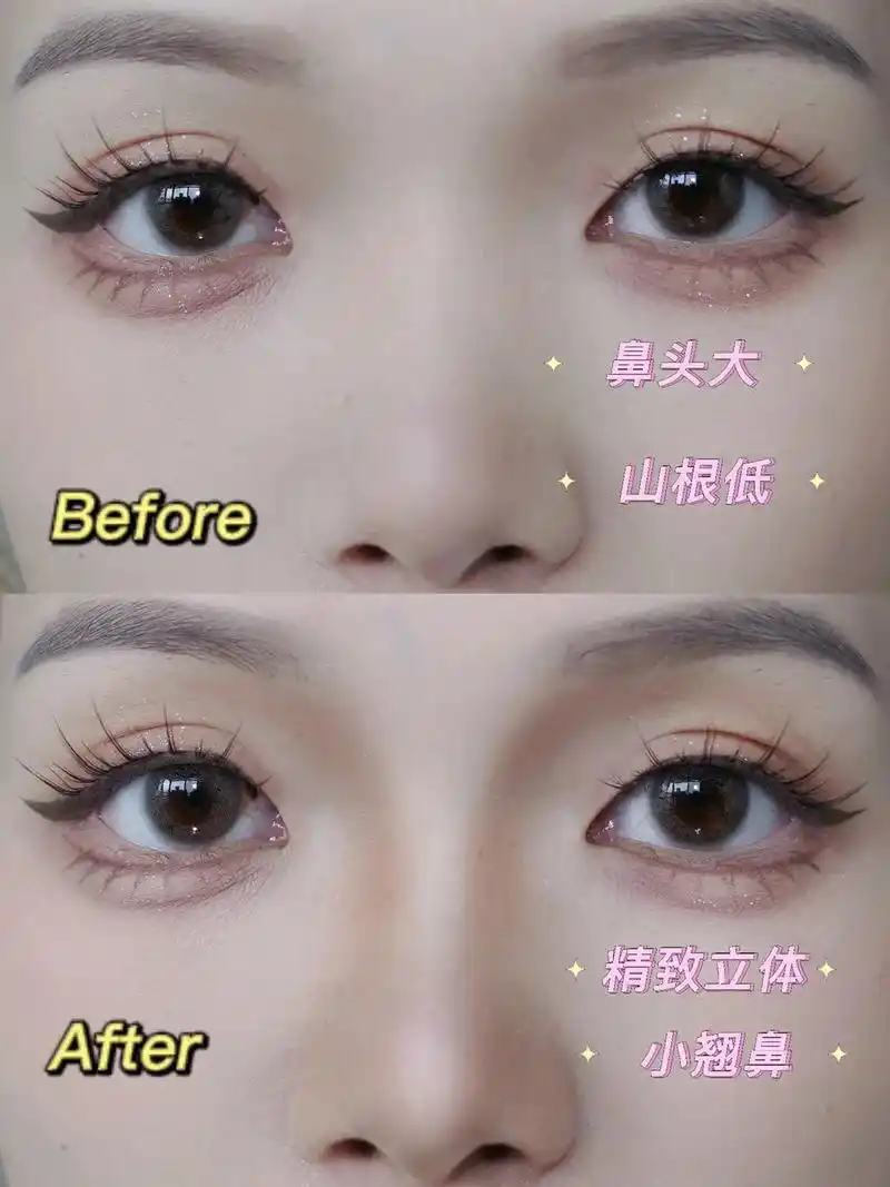 塌鼻梁山根低必学!有手就会的新手修容教程~#修容 #妆教 # - 抖音