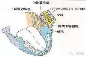 curtain内侧:舌外侧,下颌支,翼突下颌韧带,磨牙后垫下方:覆盖后下颌