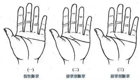 女人假断掌手相图解:假断掌的人,其感情线与头脑线虽然曾经重叠,却没