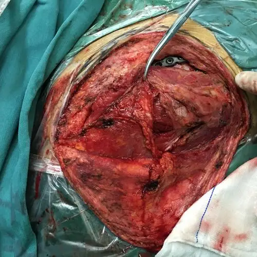 一例肩胛骨 [病例帖]