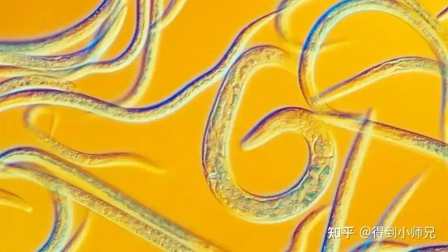 热搜榜首的虫子,吓到很多人!真是忍着巨大的恶心做完的线虫盘点(不适