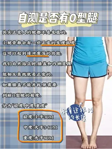 o型腿大矫正夏天就要穿上最美短裙