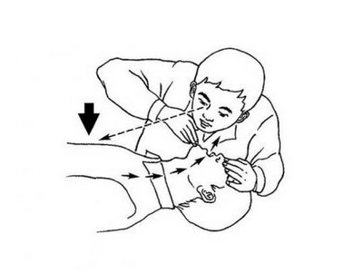 第四步:人工呼吸