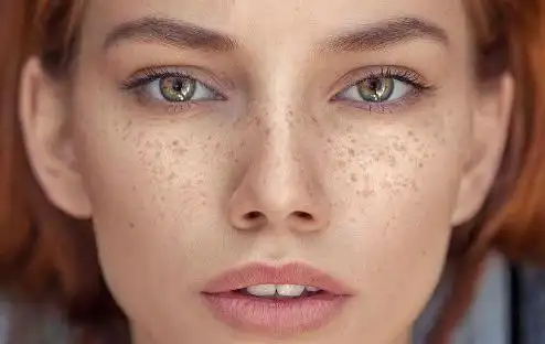 焕白美肤征程由伊肤泉美白前来助阵科学调配击溃斑脸