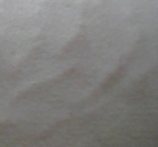 大腿上有一道一道白的