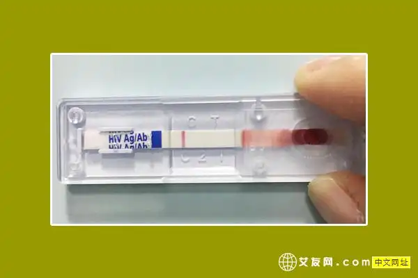 若两次以上结果相同,则100%准确,爱卫hiv抗体检测试纸是通过口腔粘膜