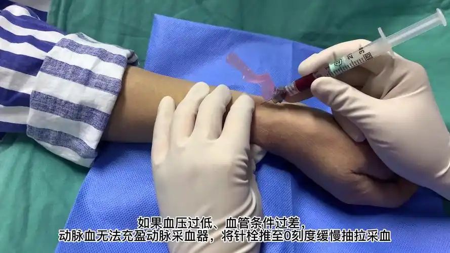 动脉血气分析标本采集技术_1