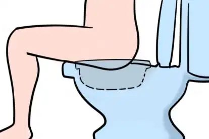 内痔坐浴的正确方法图解