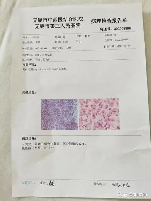 父亲48岁胃癌晚期抗癌之路