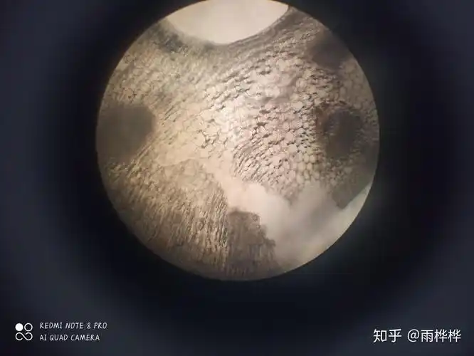 可以是细胞观察图,最好是手绘图,谢谢大家? - 知乎