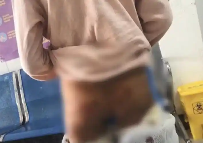 长丰县公安机关已受案调查,并将依据孩子的伤情鉴定结果和调查的事实