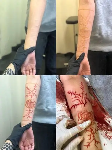 割皮纹身师小爱告诉我女孩们用剥离皮肤的方式让过去的伤痕获得新生