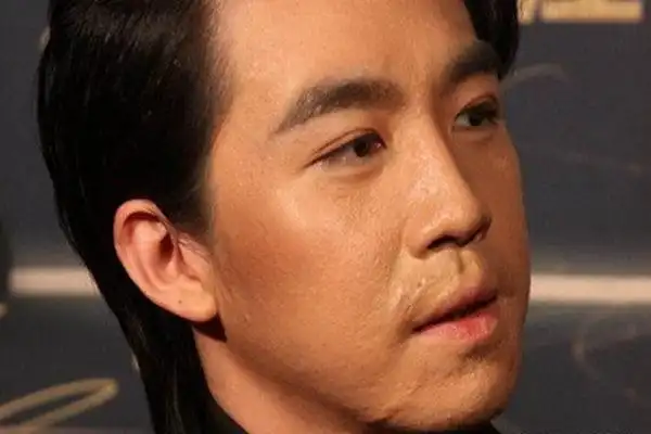 俞灏明"并没有毁容的危险",但是提及医院确定了他的烧伤等级为"深Ⅱ度