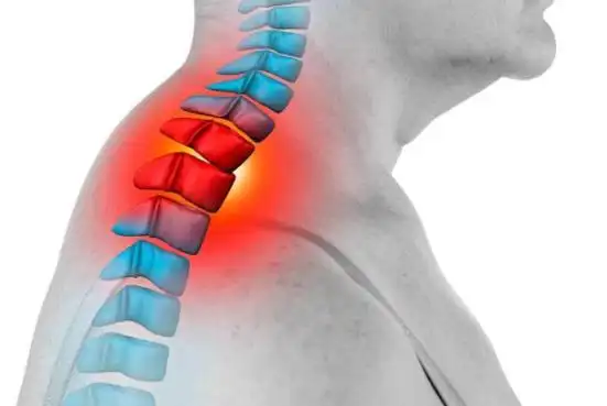 一个信号,多半是颈椎间盘突出了!