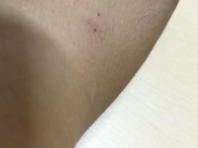  追问 不是,就是身上破了个洞洞那感觉