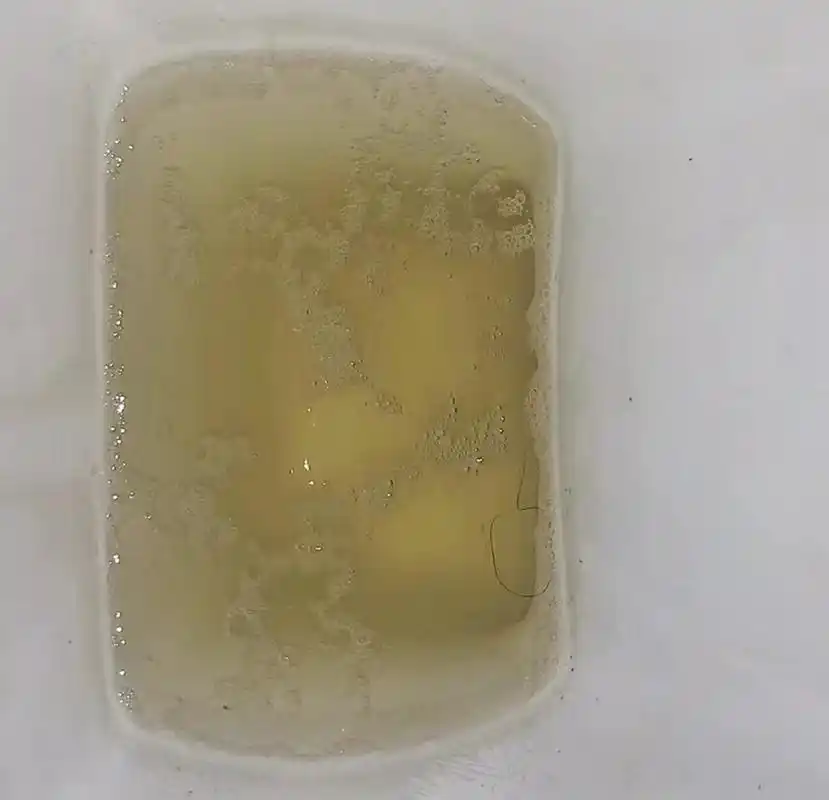 尿液中的泡沫是否与尿蛋白有关,这个问题常常困扰着许多人.