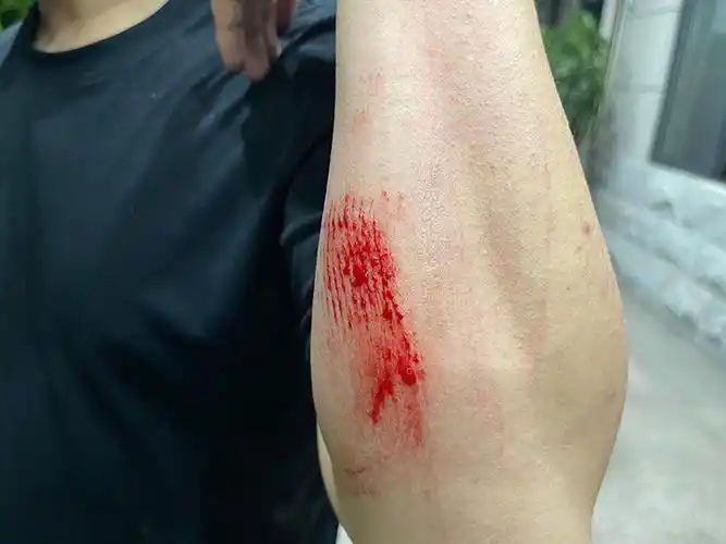 他箍住毒贩滚下高坡后第一句是先上拷