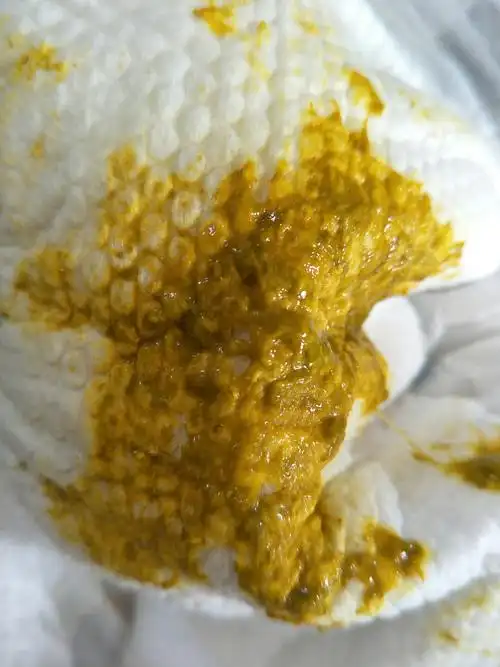 佩服!宝宝消化不良的原因"流程透明"-第1张图片-德宝网