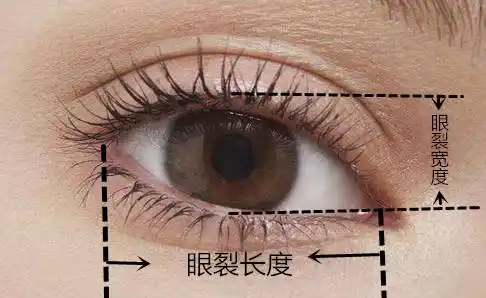 睁眼时上下眼睑之间的长度是眼裂宽度,内眦外眦之间的长度是眼裂长度