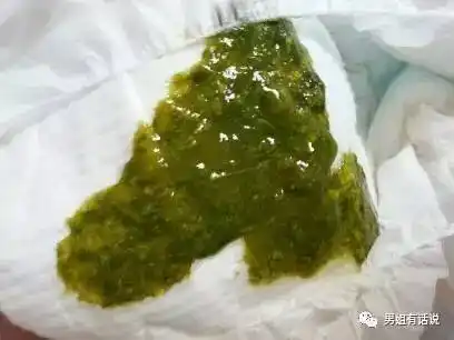 图文并茂教你看,多便便图慎入