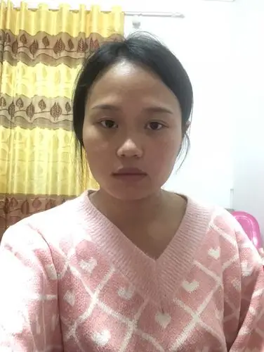 大小脸.又是方脸,想问一下医生,我这_新氧美容整形