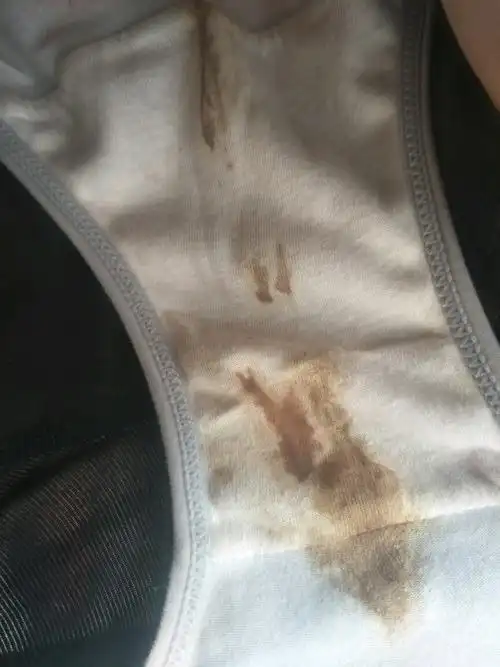 内裤上有深褐色的血