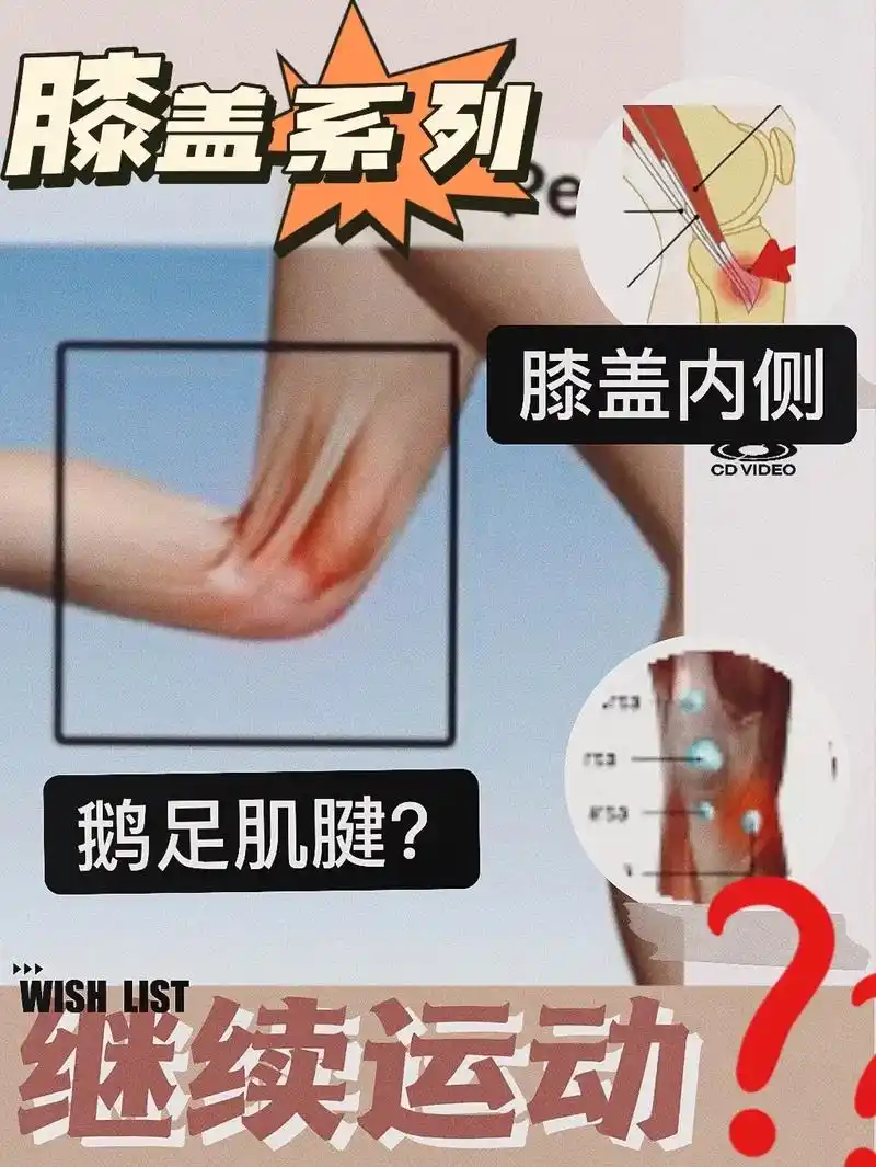 膝盖内侧不舒服.#鹅足肌腱炎#膝关节#运动康复 #健身 - 抖音