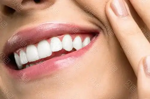 做金属托槽牙齿矫正期间应该注意哪些问题