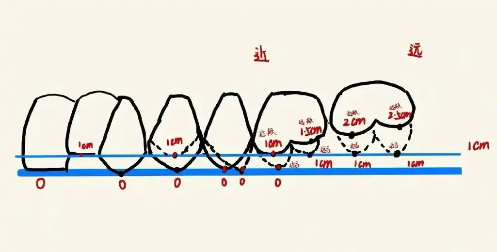 全口义齿牙尖交错位排牙指导图 #口腔科普  #全口吸附性义齿 - 抖音