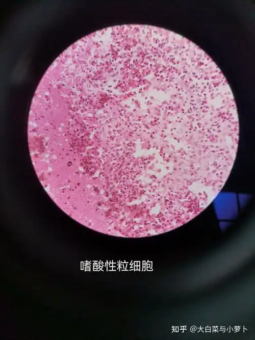 病理实验玻片及诊断